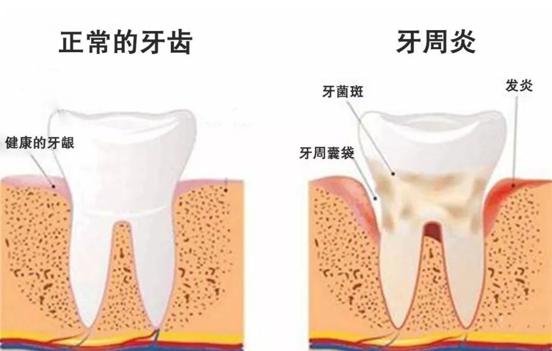 深圳牙周醫院